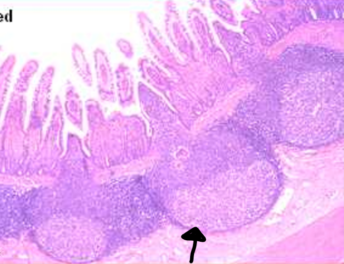 <p>the arrow is pointed to a</p>