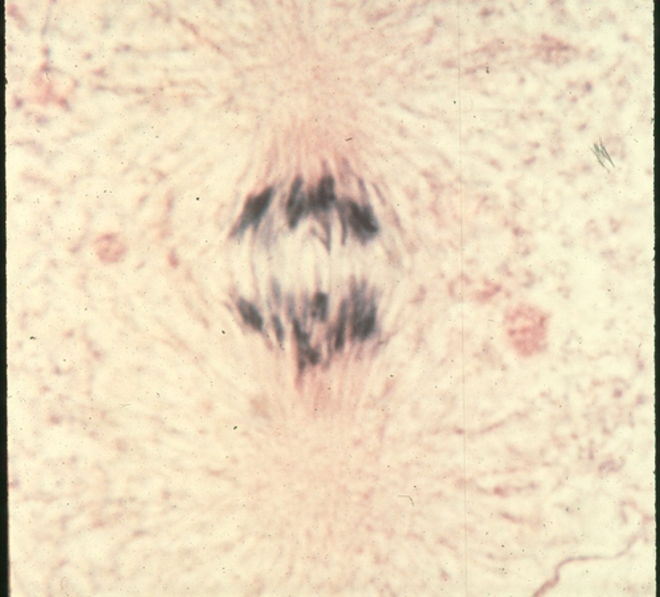 <p>This shows _______ in whitefish blastula.</p>