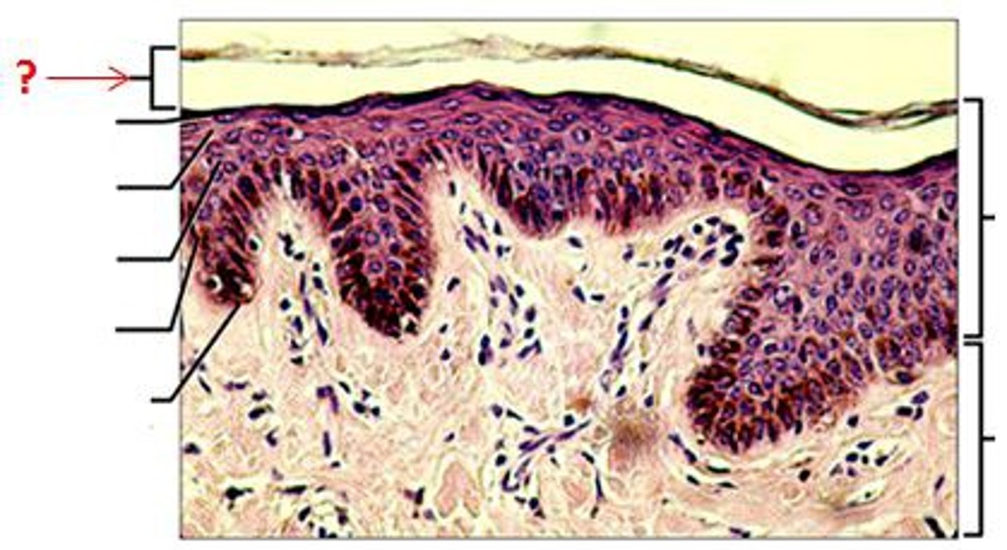 <p>outermost layer of epidermis</p>