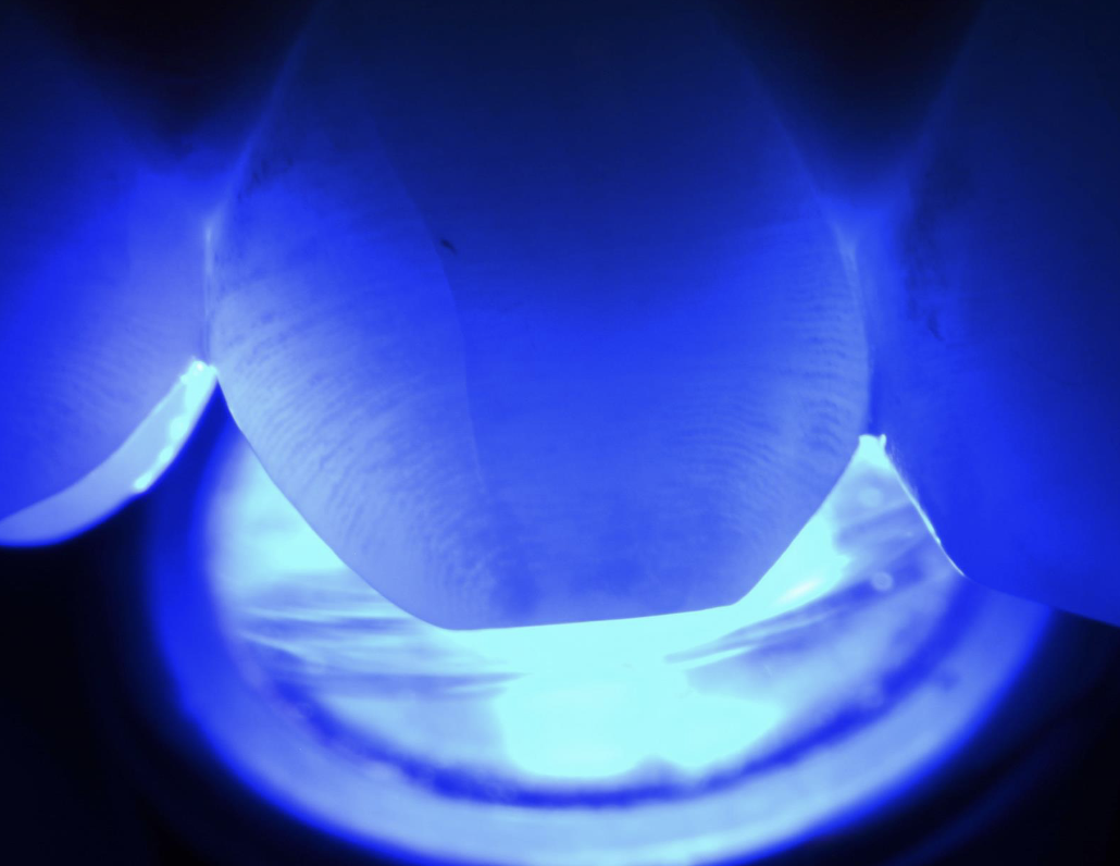 <p>transillumination</p>