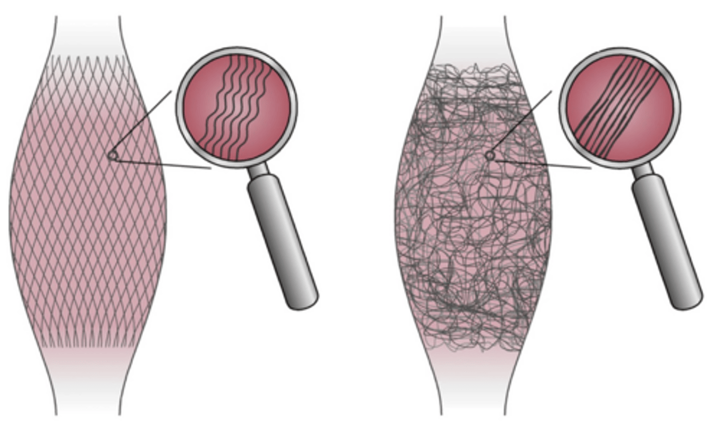 <p>Disorganized = Lose elasticity + Force transmission</p><p>- Controlled loading helps realign fibers</p>