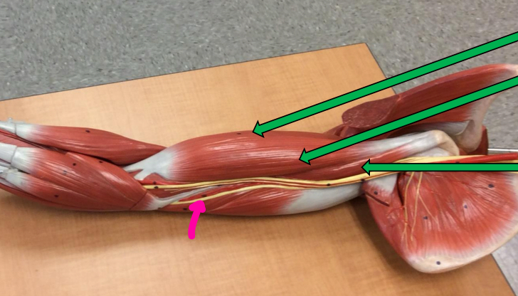 <p>Identify this muscle?</p>