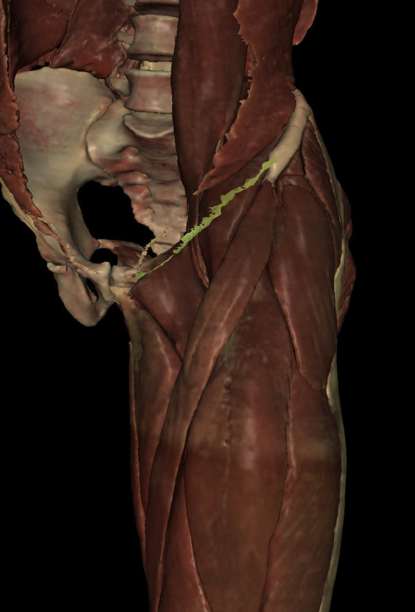 <p>Identify the Structure</p>