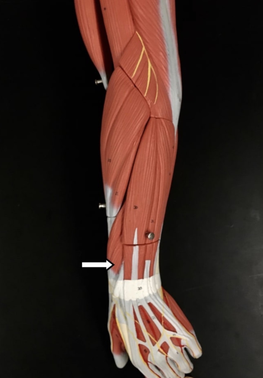 <p><span>Name the muscle labeled with the white arrow below.</span></p>