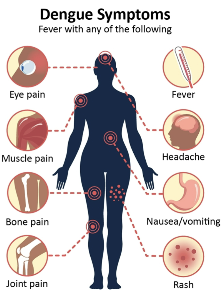 <ul><li><p>Dengue (virus): Dengue is the most common arboviral disease (viral disease transmitted by an arthropod vector)</p></li><li><p>~390 million infections and 100 million new cases each year, a small proportion of these cases progress to severe dengue</p></li><li><p>Dengue Hemorrhagic Fever: bleeding, respiratory distress, dramatic drop in blood pressure</p></li><li><p>Roughly 1 in 2,000 dengue cases result in death</p></li></ul>