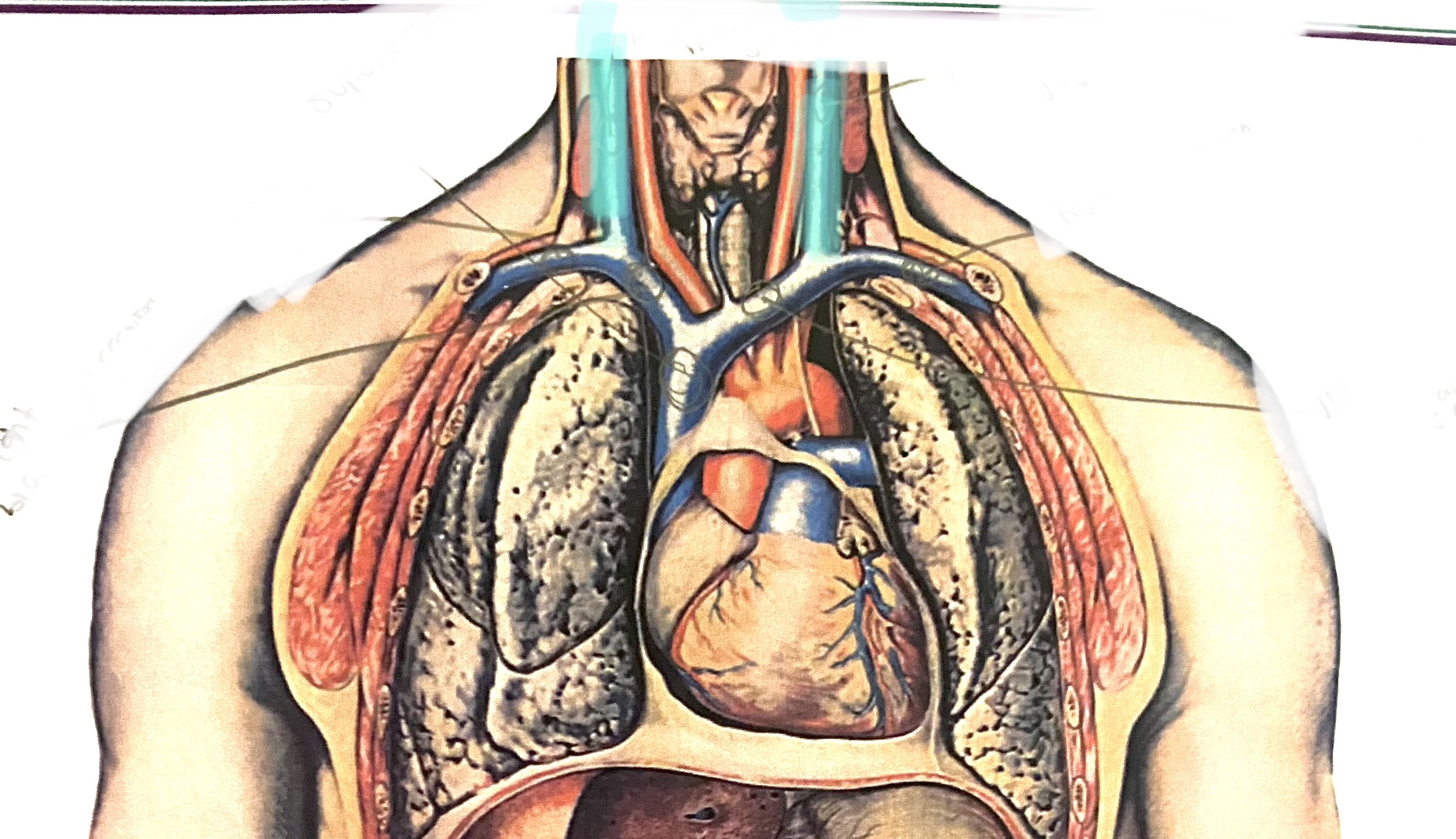 <p>Internal jugular vein</p>