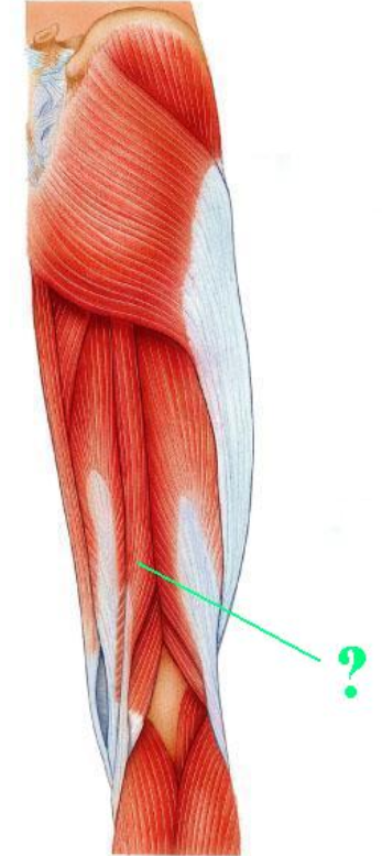 <p><span>Identify the indicated muscle.</span></p>