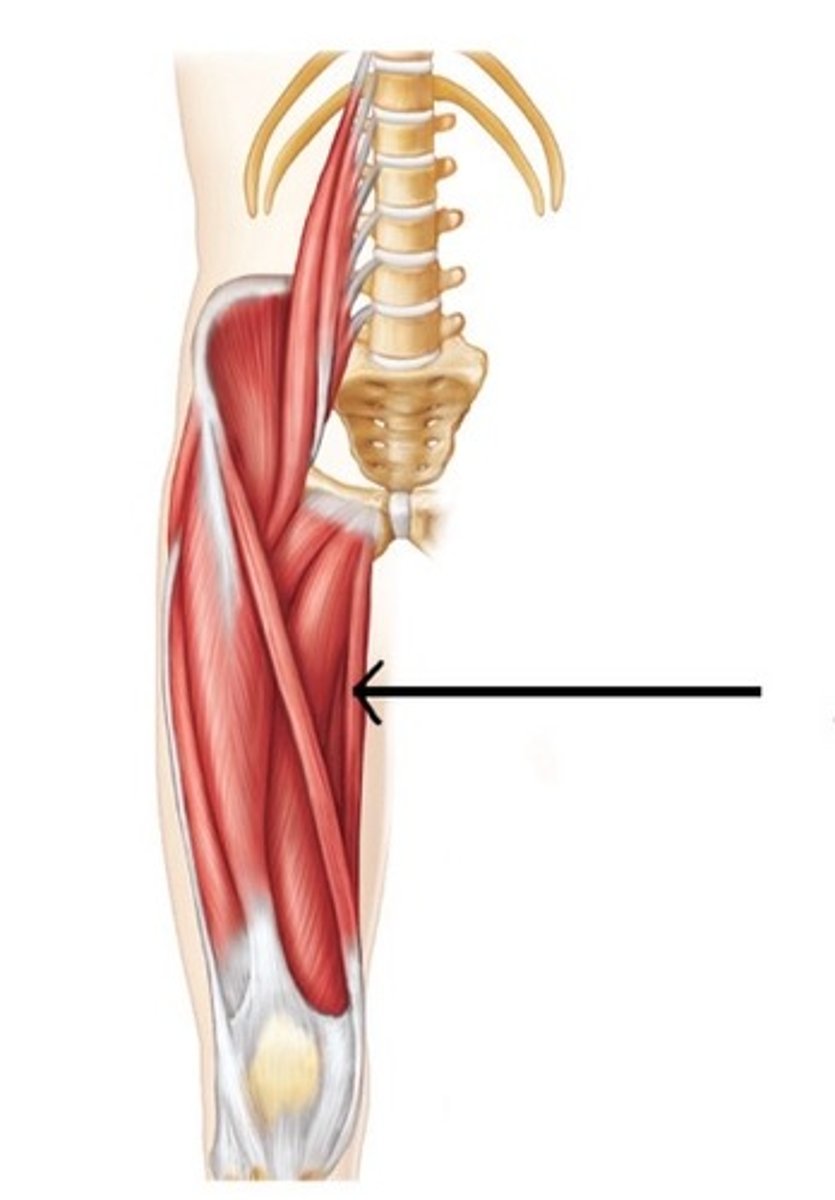 <p>What muscle is this?</p>