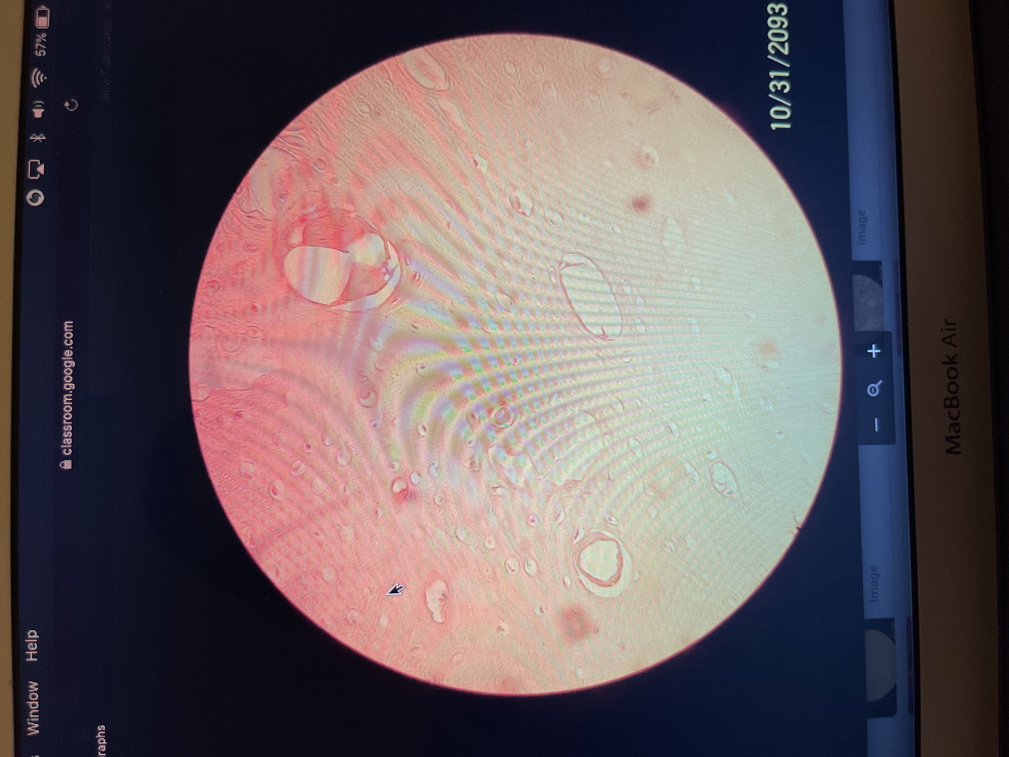 Location:various parts of bones of the body
Function: support, protection storage