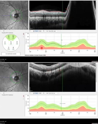 <p>scan capture issues</p>