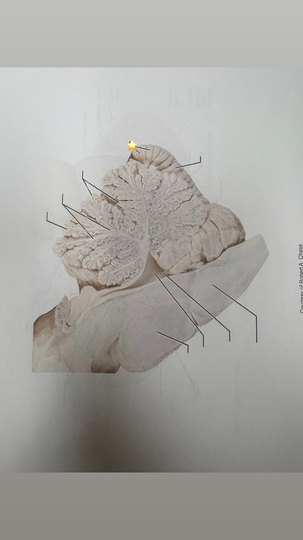 <p>name the starred structure</p>