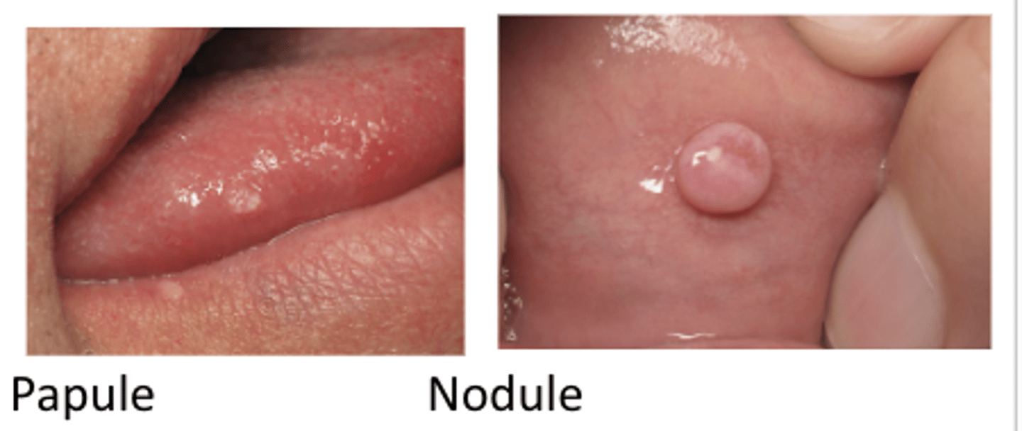 <p>raised lesion</p><p>nodule > 1 cm</p><p>papule < 1 cm</p>