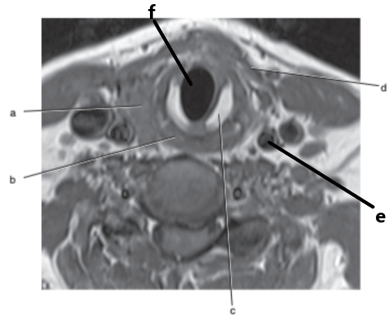 <p>What is letter c ?</p>