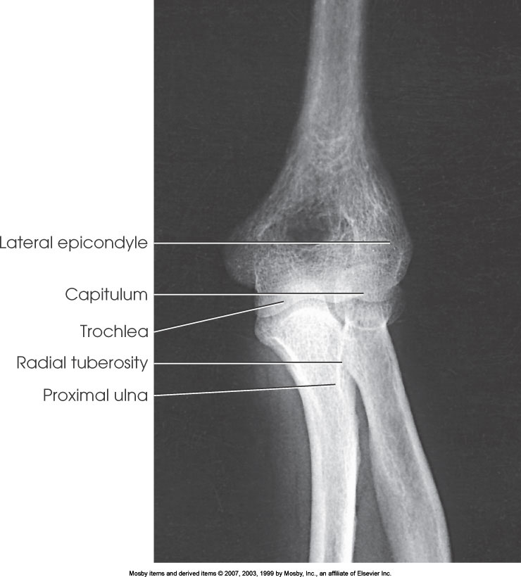<p>What position is demonstrated?</p>