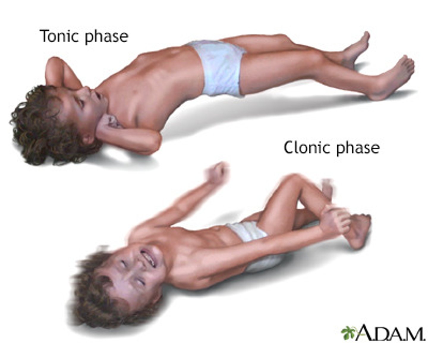 <p>- stiffening and jerking movements</p><p>- loss of consciousness</p><p>- moaning/painful sounds</p><p>- frophing at the mouth</p>