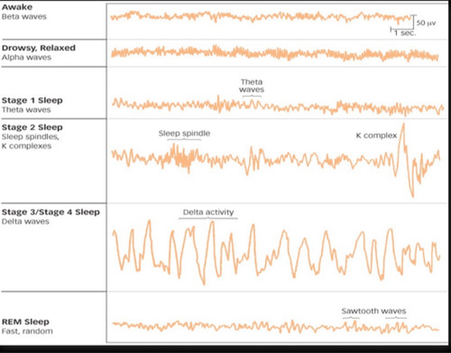 <p>Stage 1 </p><p>• Stage when first </p><p>falling asleep (hypnagogia) </p><p>. theta waves</p><p>Stages 2 through 3/4 </p><p>(slow-wave sleep) </p><p>• light sleep</p><p>•processing of memories </p><p>• high-intensity brain waves </p><p>• 55% of all sleep</p><p>Stage 3 </p><p>• sleep lightens</p><p>• greater muscle relaxation</p><p>- Delta waves</p><p>- makeup 20-25% of sleep </p><p>REM sleep </p><p>• rapid eye movement</p><p>• resemble beta waves </p><p>• Brain waves similar to </p><p>wakefulness</p><p>• associated with dreaming</p>
