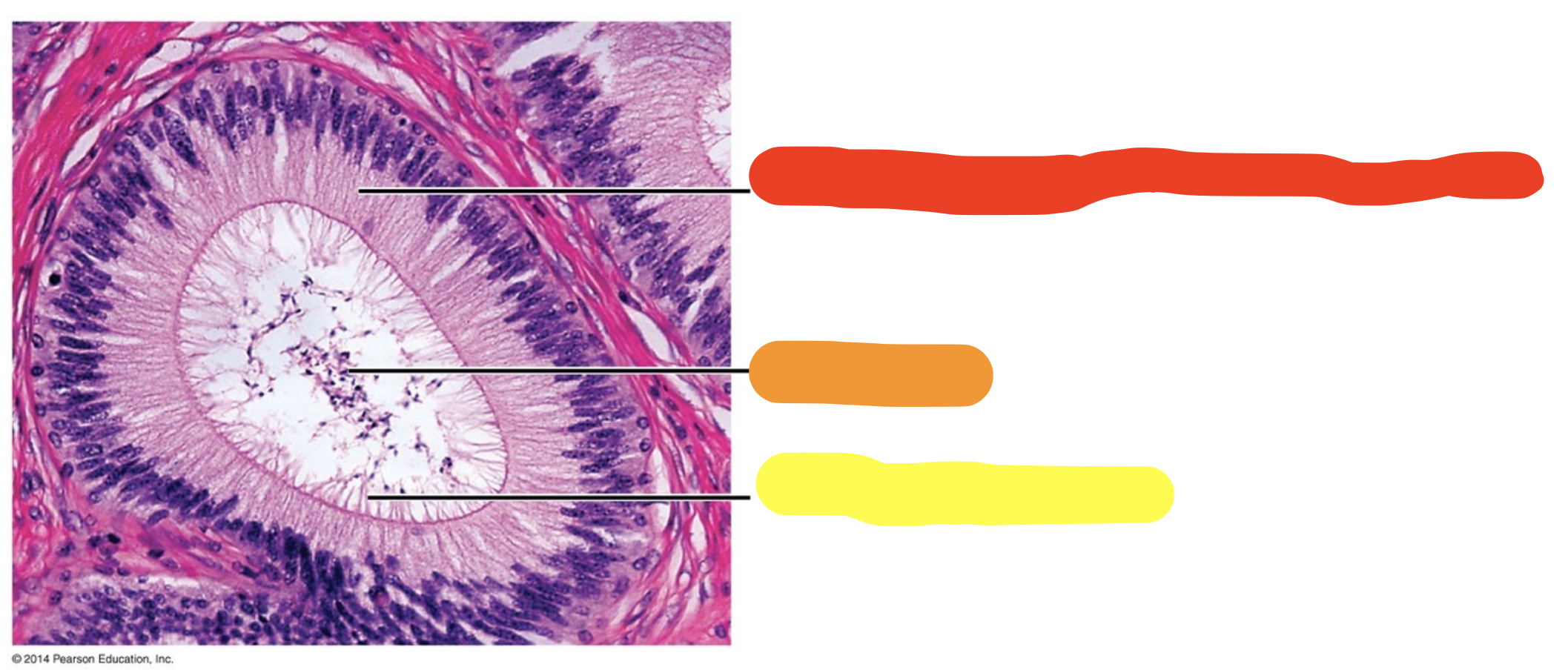 <p>What is yellow?</p>