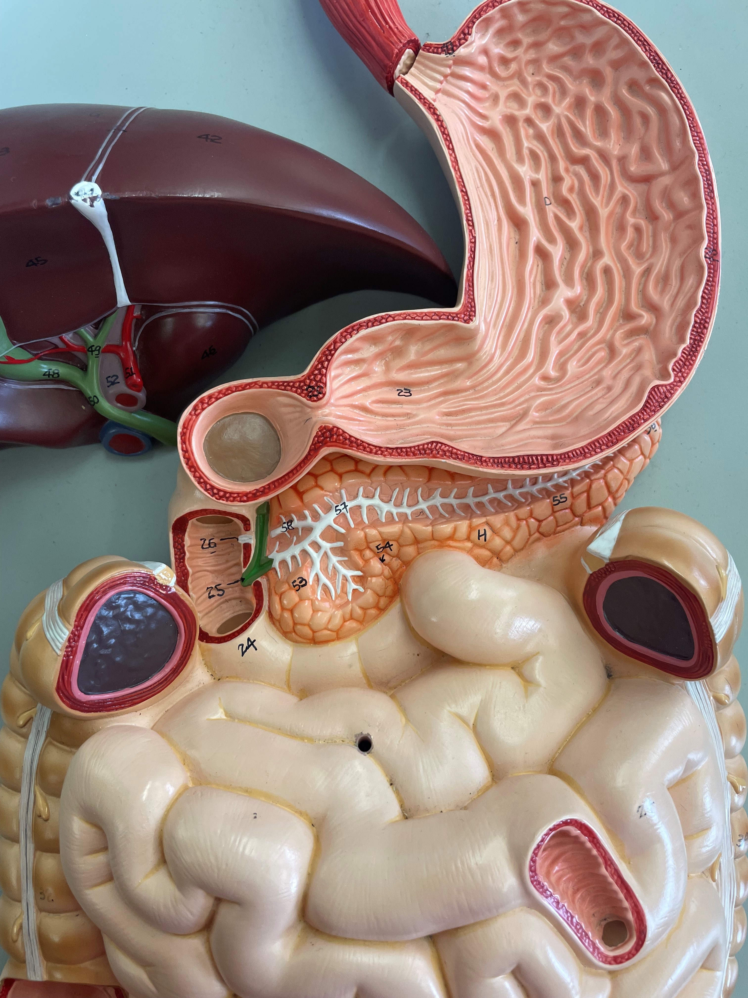 <p>An accessory organ of digestion, H</p>