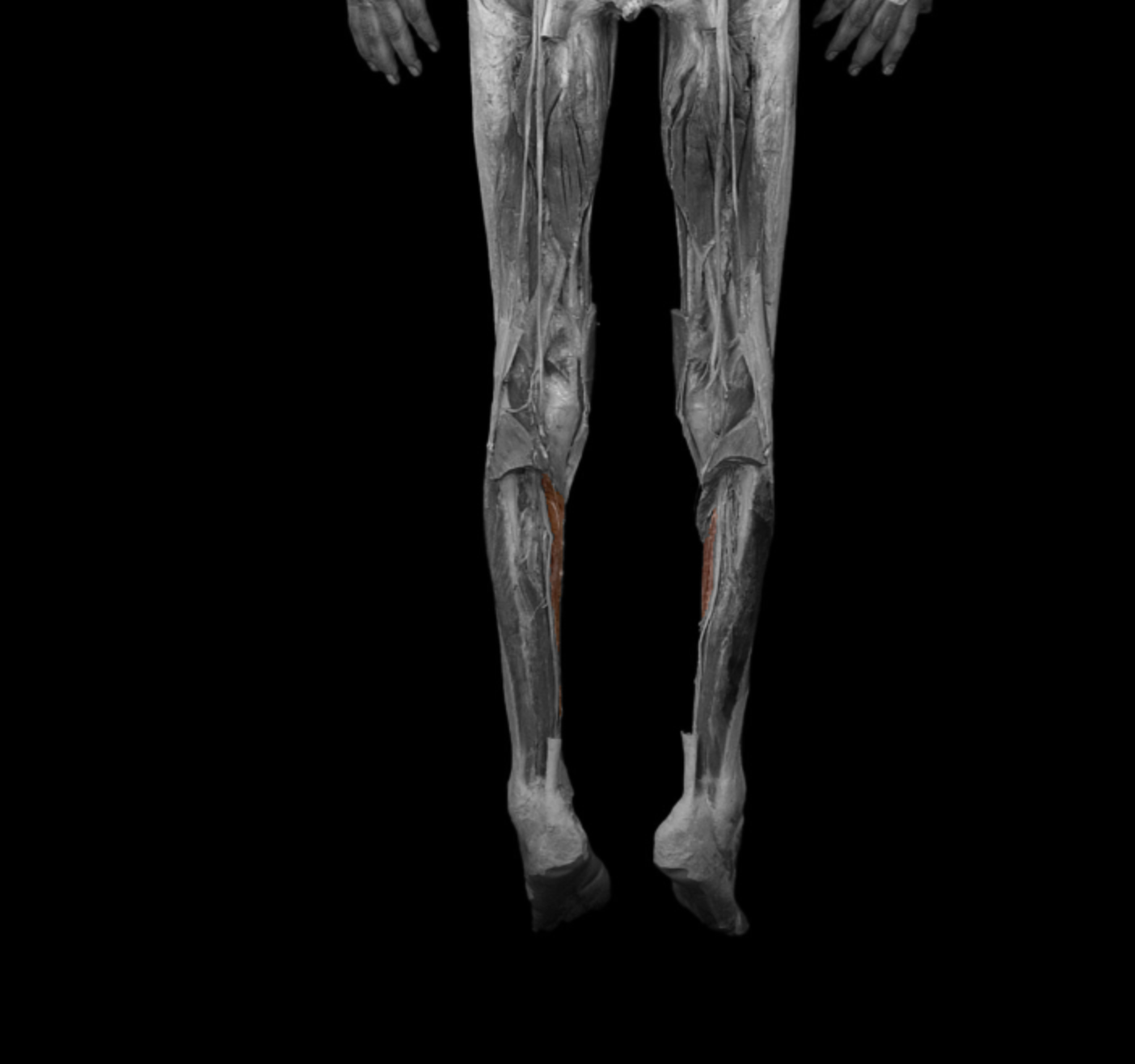 <p>origin: posterior surface of tibia </p><p></p><p>insertion: distal phalanges II-IV </p><p></p><p>action: plantar flex, flex toes</p><p></p><p>innervation: tibial nerve </p>