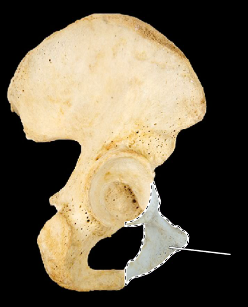 <p>Name this bone.</p><p>(Lateral view, right).</p>