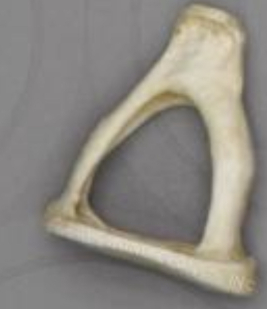 <p>What auditory ossicle is this</p>