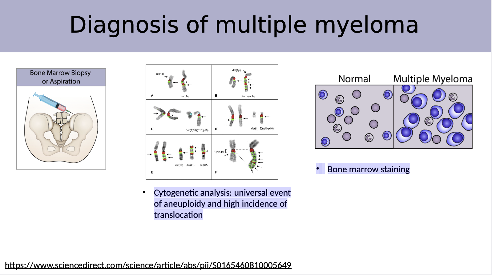 <ul><li><p>Cytogenetic analysis: universal event of aneuploidy and high incidence of translocation </p><p></p></li><li><p>Bone marrow staining helps identify abnormal cells and assess the bone marrow's overall health.</p></li></ul><p></p>