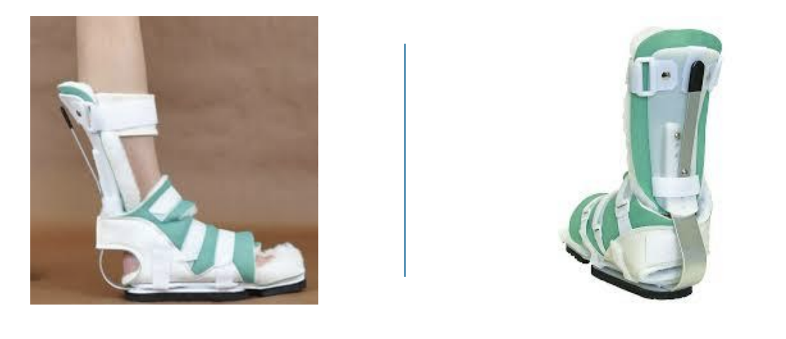 <p>effective in prevention of ankle contracture</p>