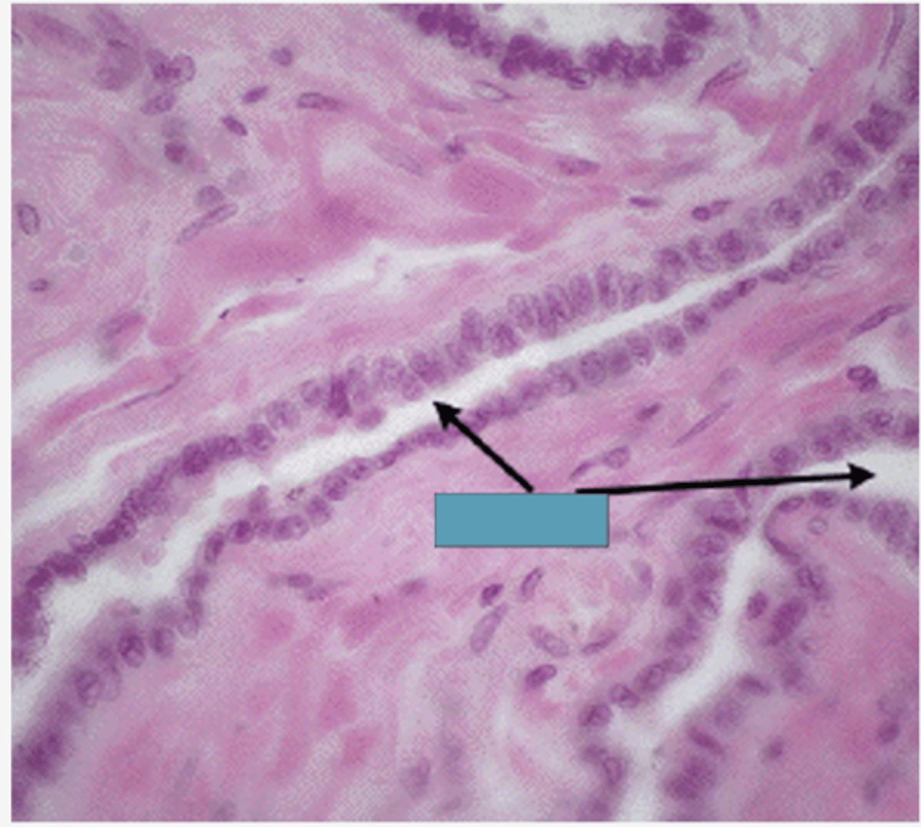 <p>Identify the structure of the testis</p>