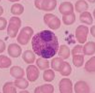 <p>have cytoplasmic granules that stain red</p>