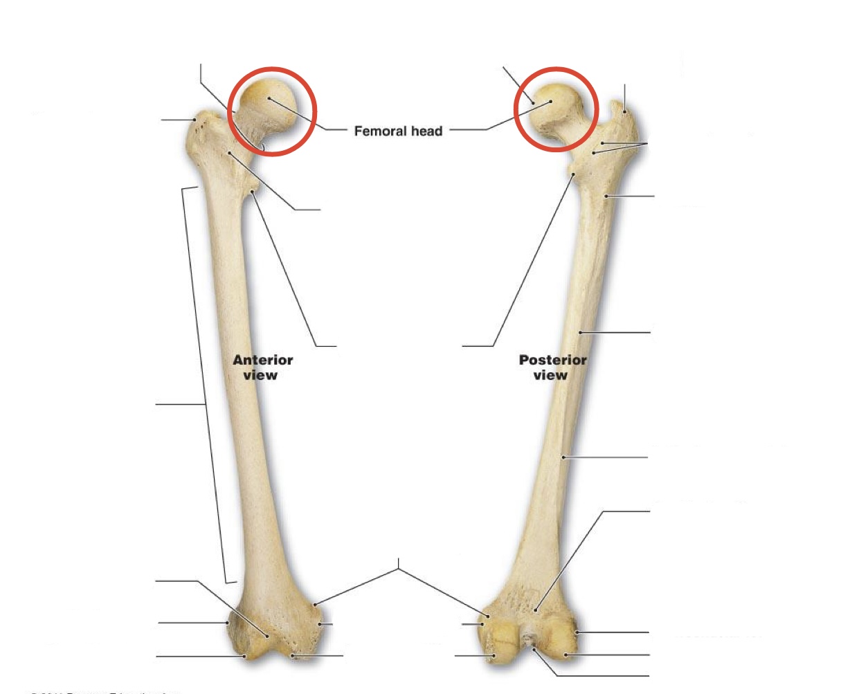 <p><span><span>Femur Head</span></span></p>