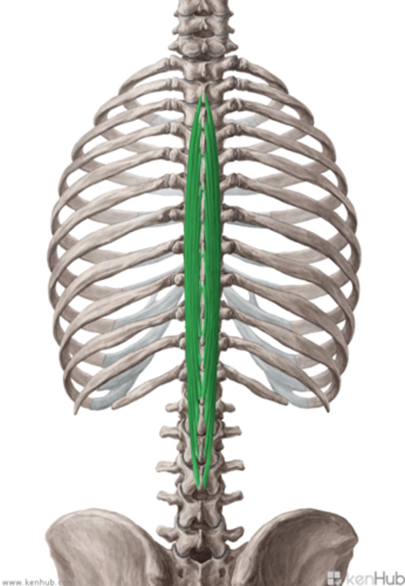 <p>The most medial muscle of the erector spinae group, assisting in spinal extension.</p>