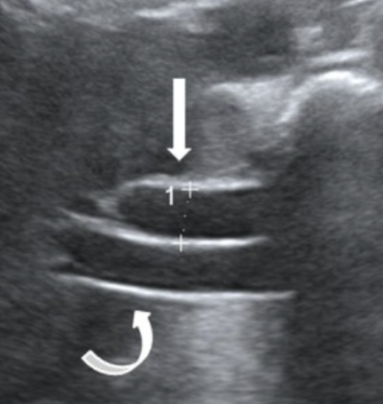 <p>what is shown?</p>