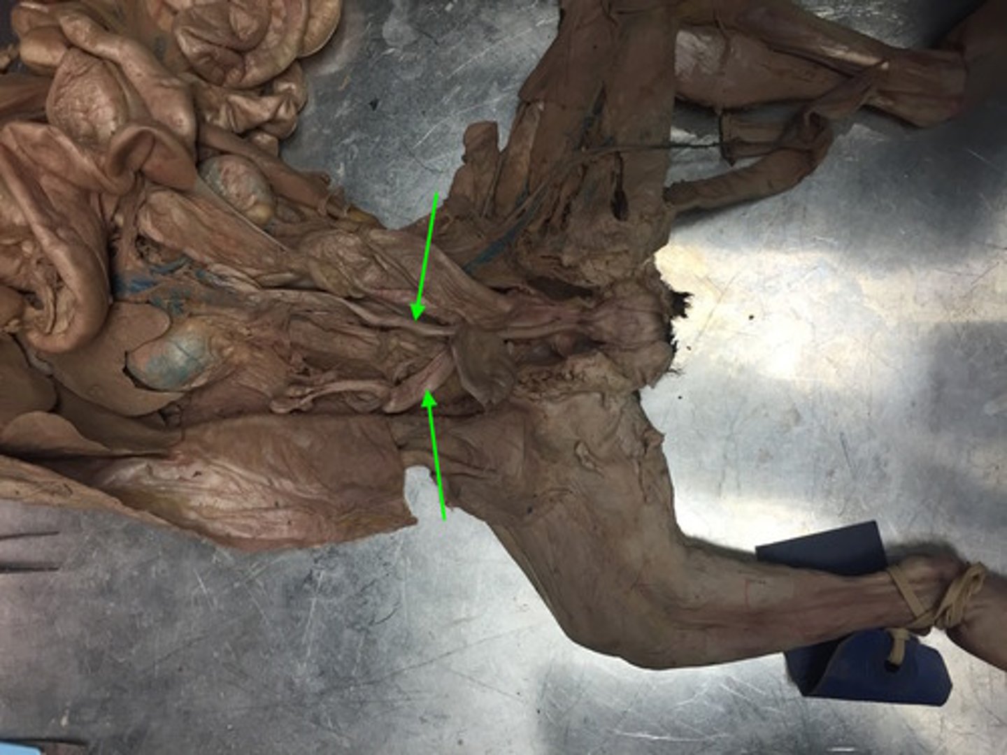 <p>Houses developing fetuses</p>