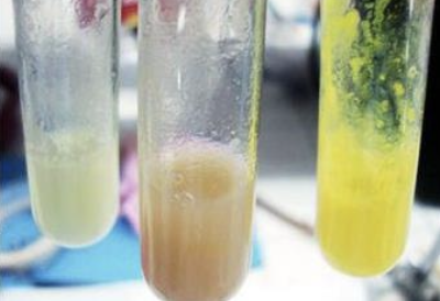 <p>What are the reagents in the 2nd test tube (middle)?</p>