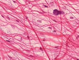 <p>What tissue is this</p>