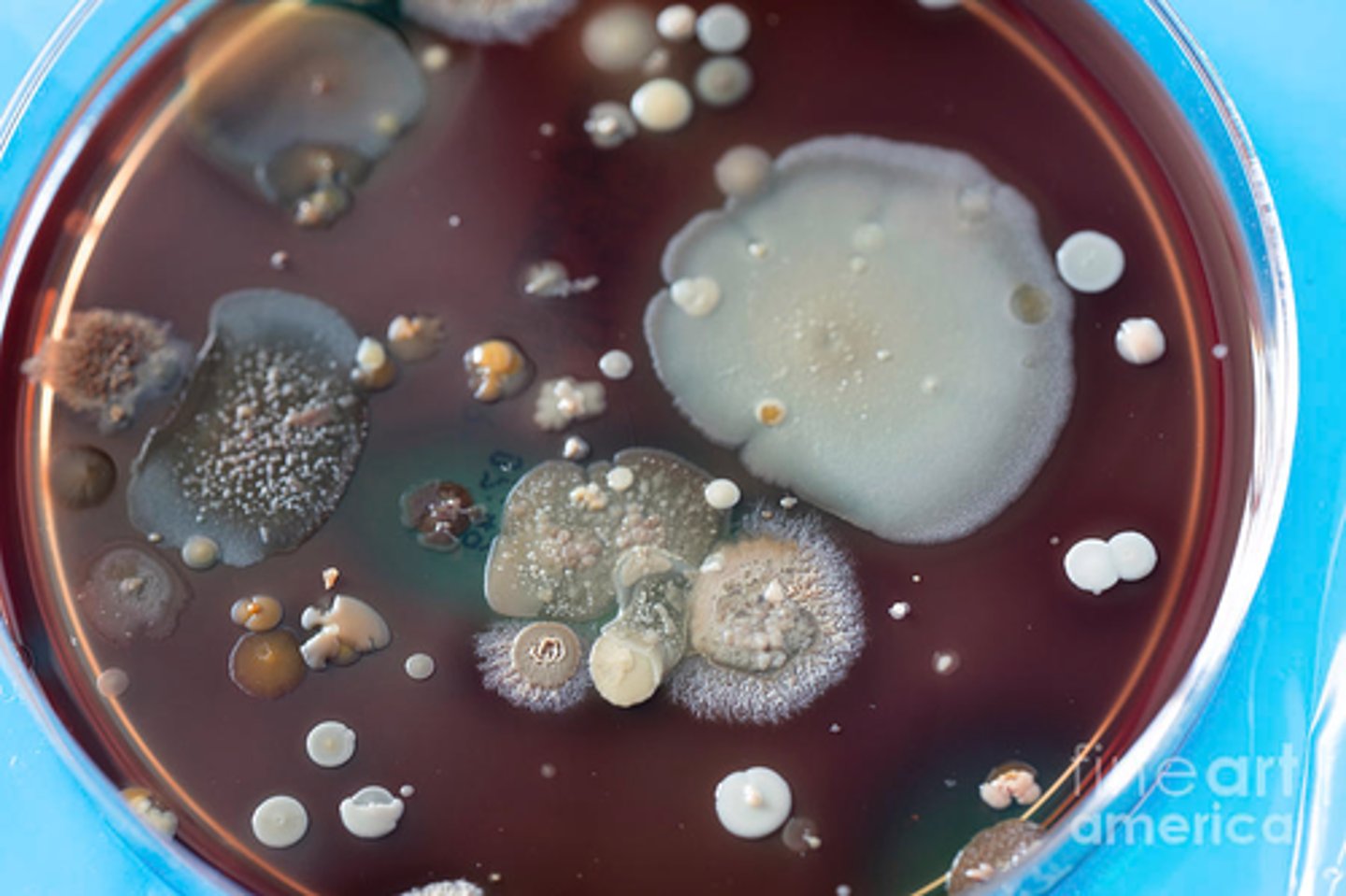 <p>Practice: Describe the morphology of as many colonies possible.</p>