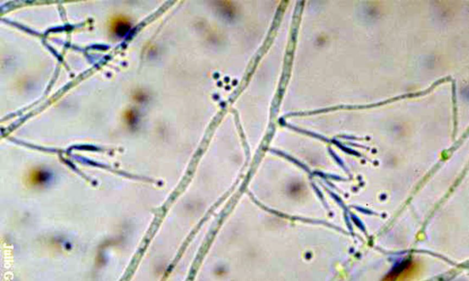 <p>Microscopic: branching conidiophores with flask-like phialides in pairs or brush-like groups, long chains of oval microconidia, resembling penicillium</p><p>Colony: yellowish brown, pink, white with reverse off-white, light yellow, pale brown</p>