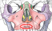 <ul><li><p>largest immovable bones of the face</p></li><li><p>articulates with all other facial bones, except for mandible</p><ul><li><p>also articulates with frontal and ethmoid bones</p></li></ul></li><li><p>form part of lateral walls and most of floor of nasal cavity</p></li><li><p>form part of floor of orbit</p></li><li><p>form ¾ of roof of mouth</p></li><li><p>have zygomatic process that articulates with zygoma to form part of cheek</p></li><li><p>contains maxillary sinus</p></li></ul><p></p>