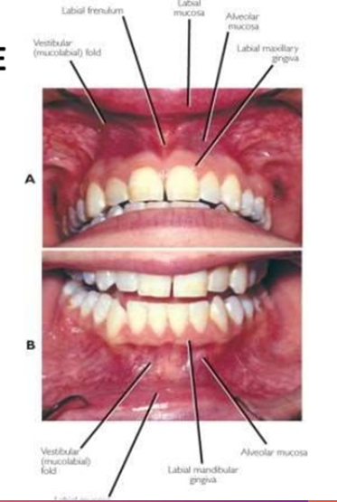 <ul><li><p>surrounds maxillary and mandibular teeth </p></li><li><p>composed of a firm pink oral mucosa</p></li></ul><p></p>
