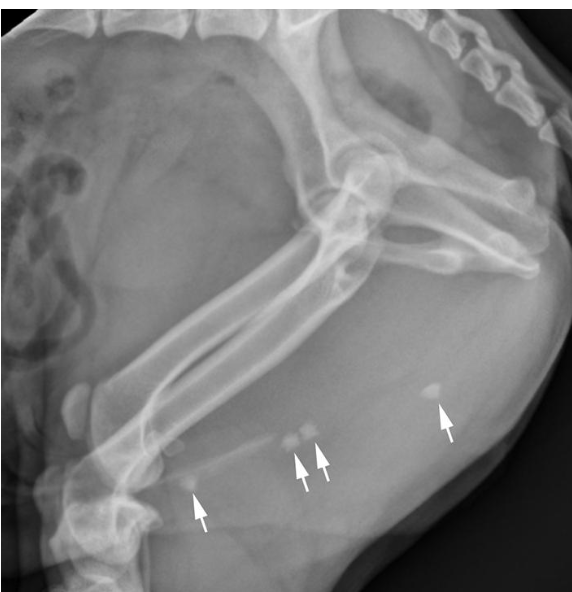 <p>MCQ: what organ is obstructed by the calculi?</p>