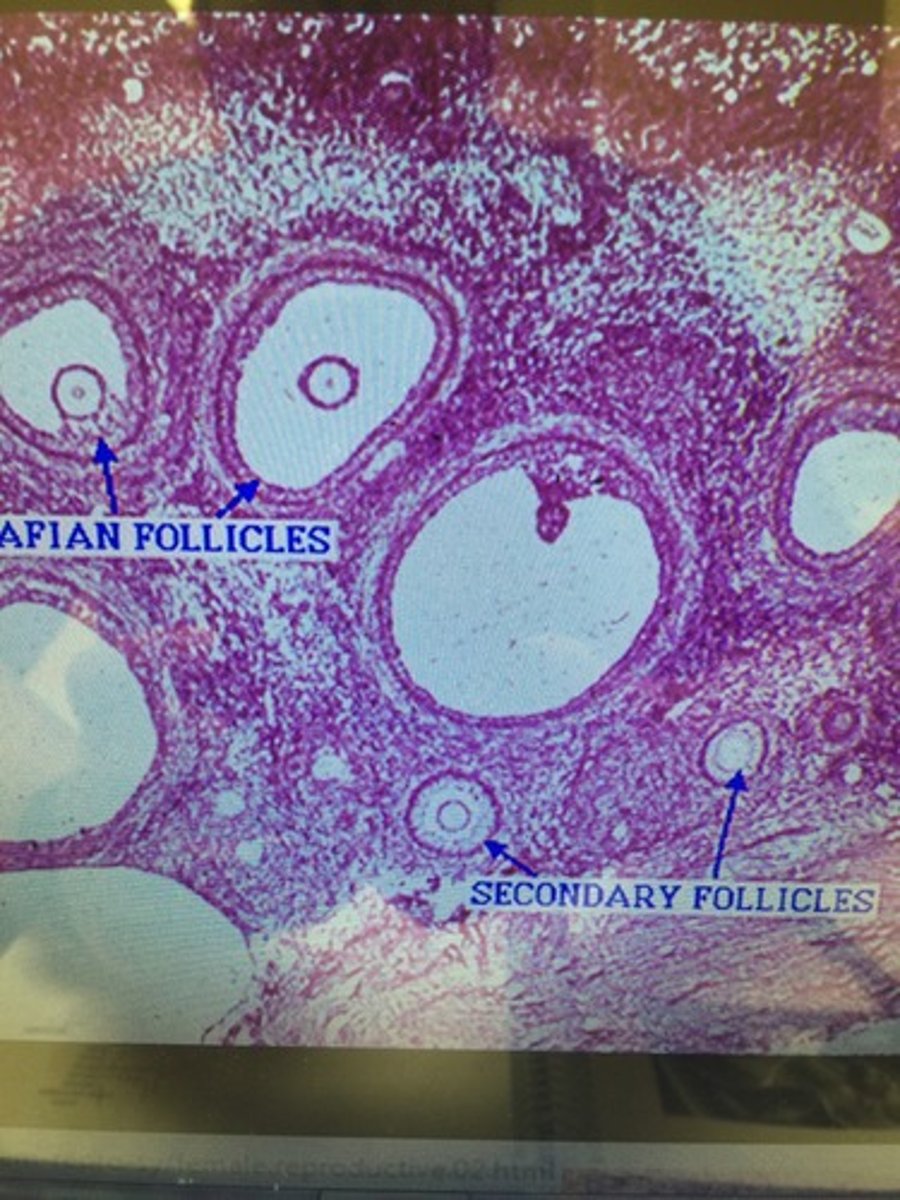 <p>What structure in the female reproductive is this slide?</p>