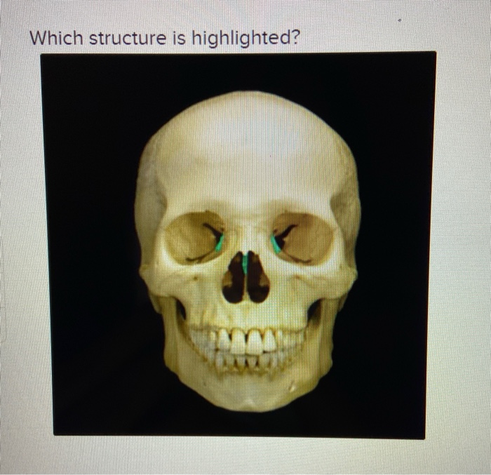 <p>Q. What structure is highlighted?</p>