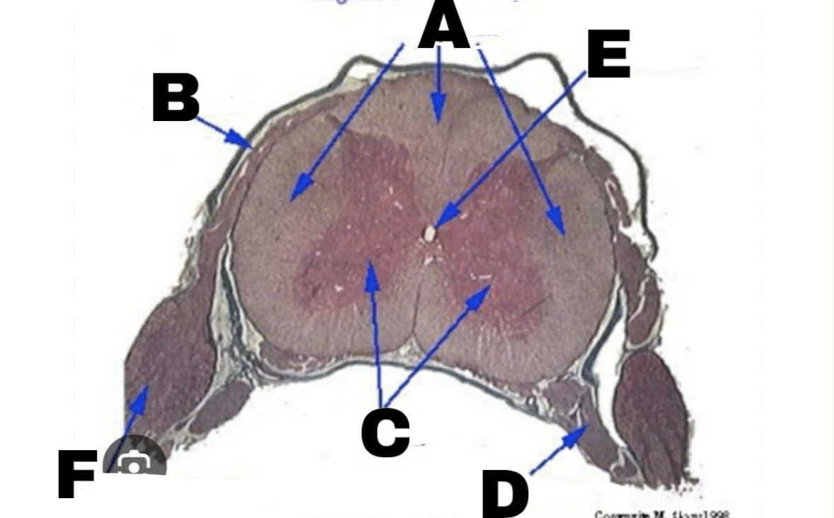 <p>A</p>