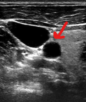 <p>Identify this image. </p>