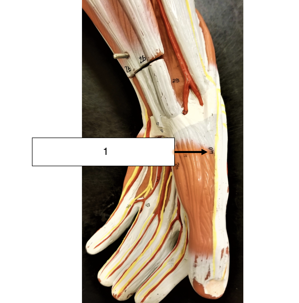 <p>name the muscle (1)</p>