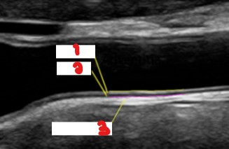 <p>Label the layers of the arterial wall seen here.</p>