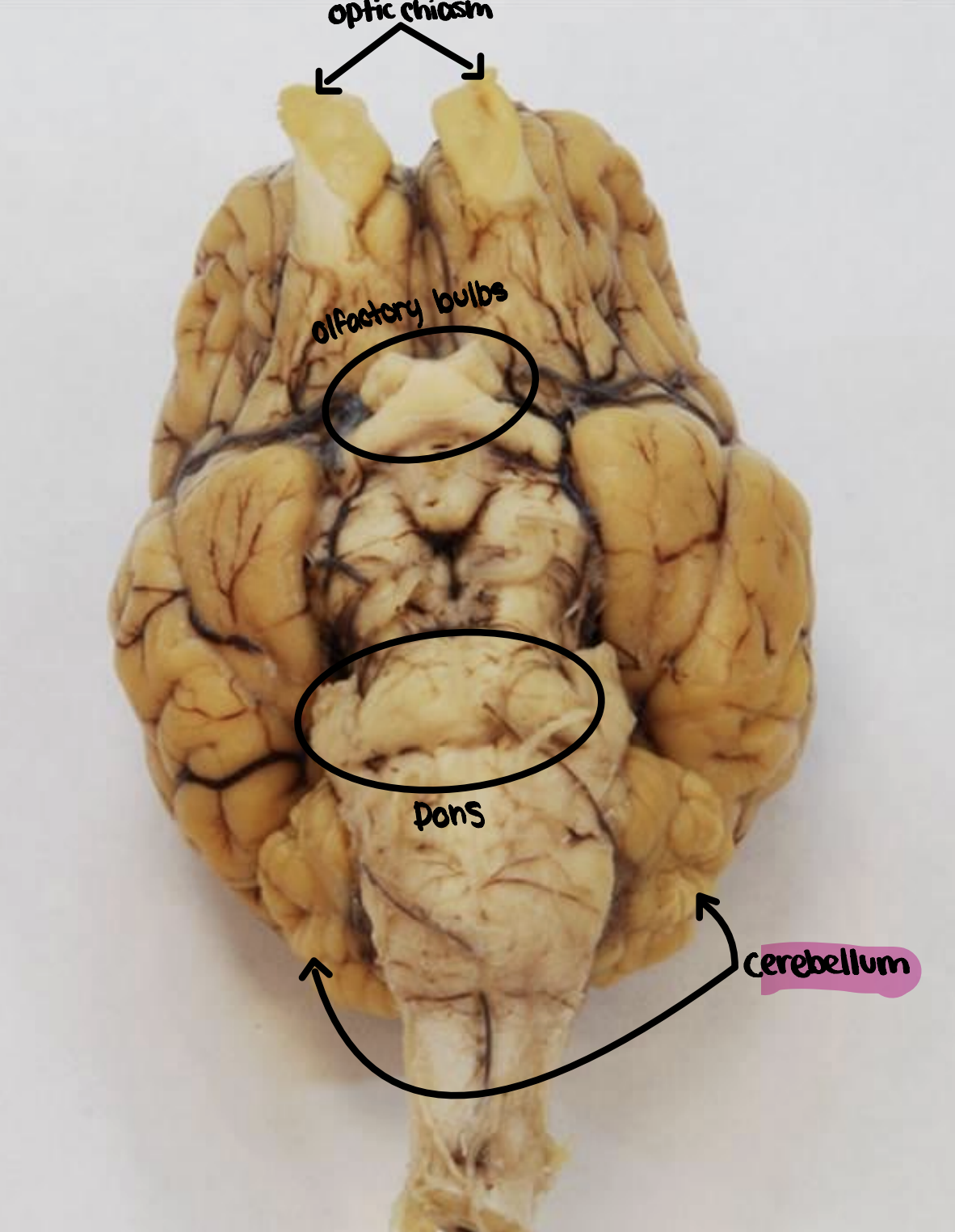 <p>Cerebellum</p>