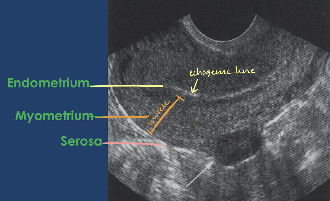 <ul><li><p><strong>innermost</strong> layer</p></li><li><p>thickness and appearance <strong>depends on menstruation cycle</strong></p></li><li><p><strong>echogenic</strong>-mildly hypoechoic</p></li></ul><p></p>