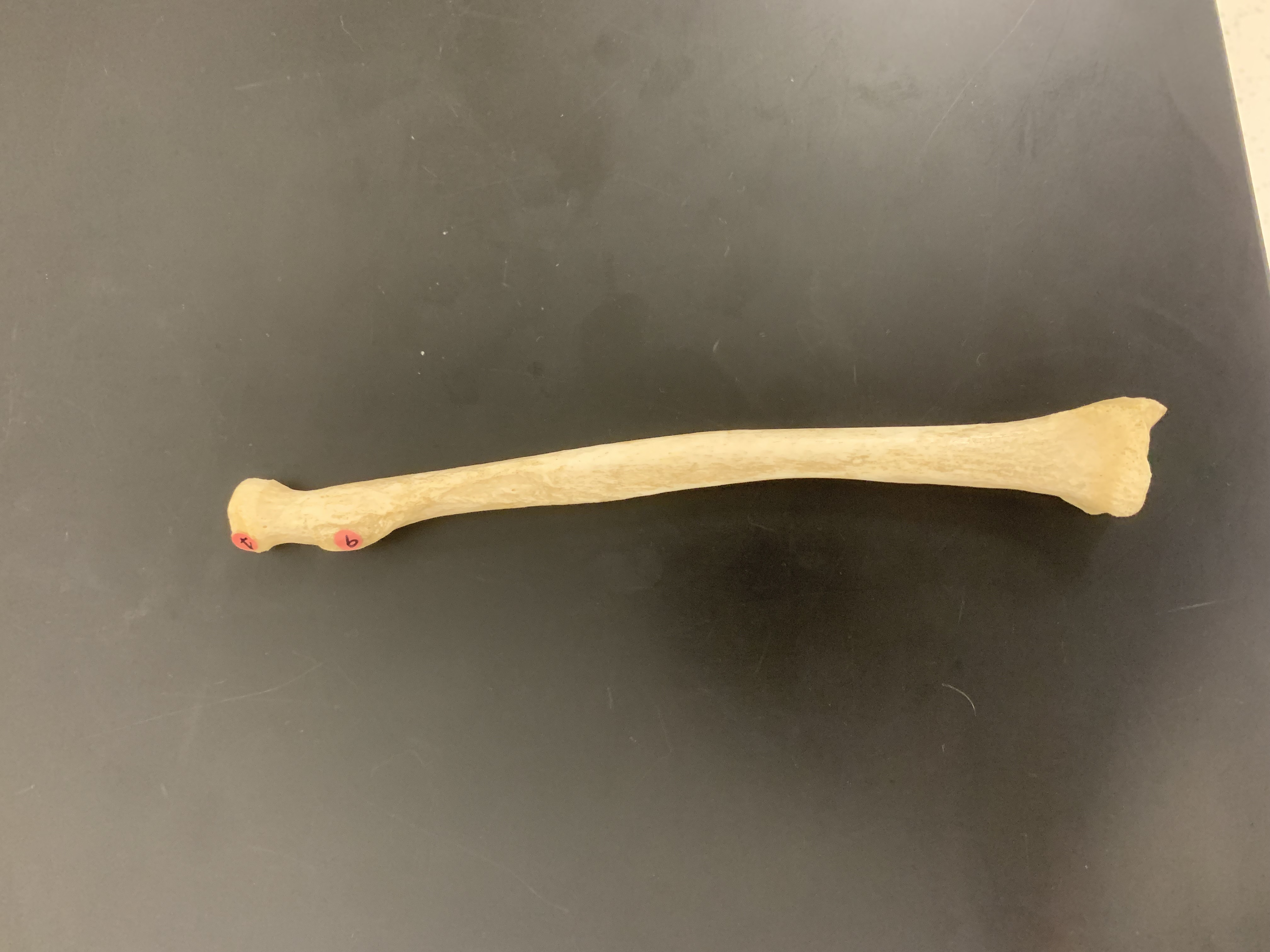 <p>Radial Tuberosity</p>