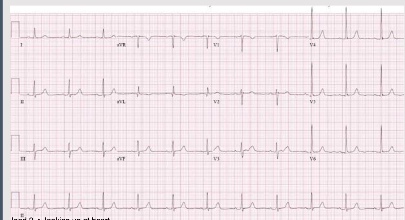 <p>ECG interpretation</p>